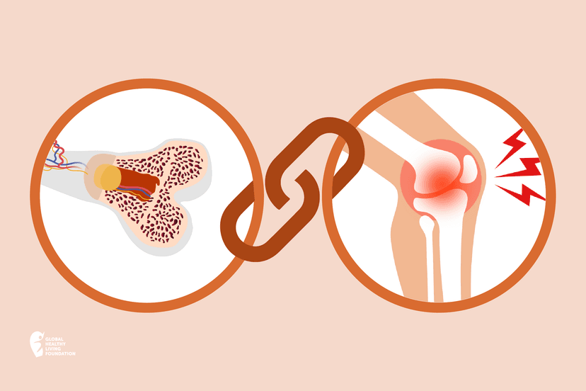 Arthritis & Osteoporosis Management