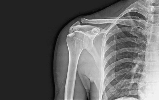 Digital X-ray Services